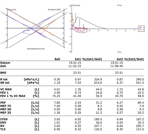 COPD Diagnostik